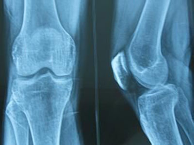 腰腿痛的病因及其可以引起的疾病分類