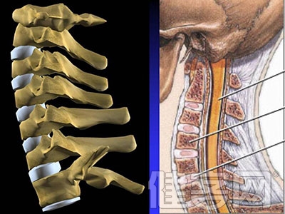 增生性脊柱炎的病因與發病機制有哪些？