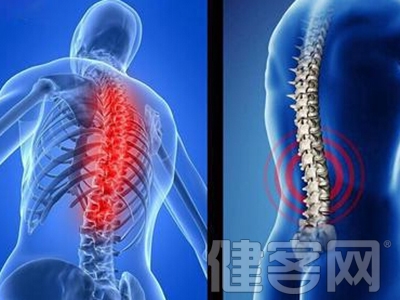 脊柱結核主要由什麼原因引起呢？