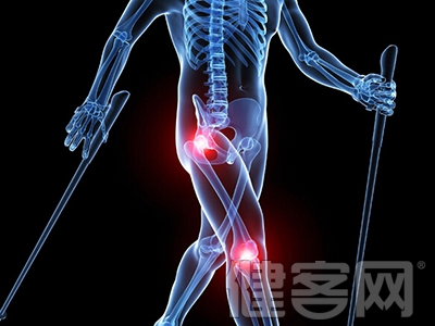 膝關節骨性關節炎怎麼引起的