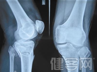 老年人患滑膜炎常為膝關節炎的伴隨過程