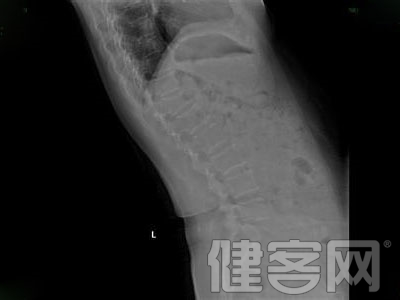 脊柱疼痛是什麼原因引起的