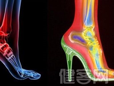 查看哪些是足部骨折的病因