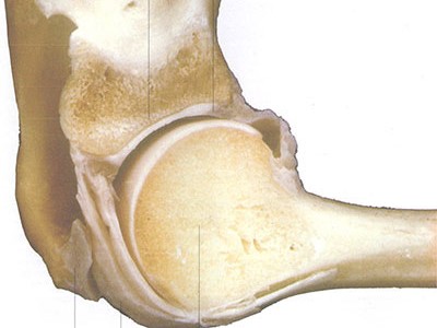 骨質疏松並不等於缺鈣