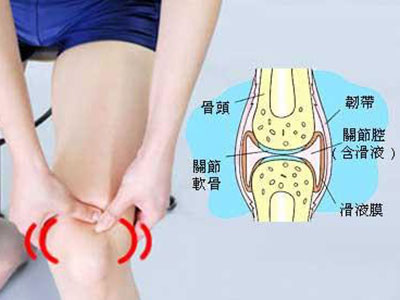 腰腿疼痛輕易按摩或致更嚴重
