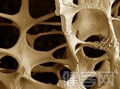 骨質疏松認識上的常見誤區