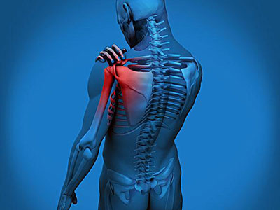 肩周炎的危害---治療預防是關鍵