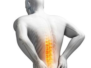 下腰痛是腰椎間盤突出症嗎？