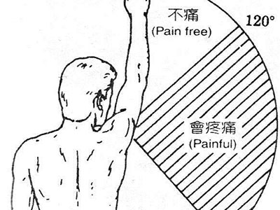 加強力量練習預防肩關節脫位