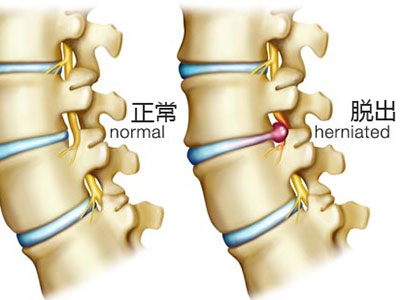 腰痛怎麼辦？參考一下這些建議吧