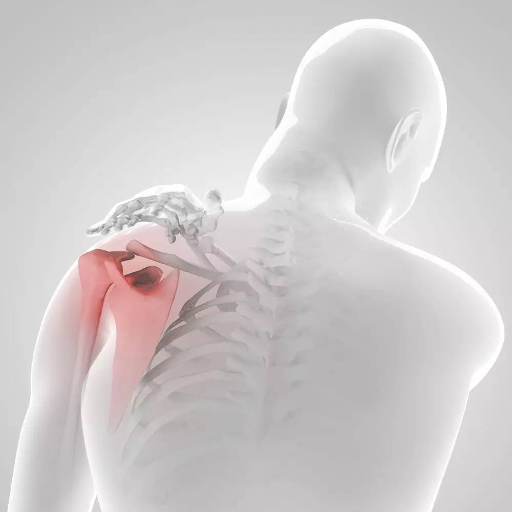 怎麼治療肩關節疼痛