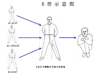 跷二郎腿傷腰椎間盤