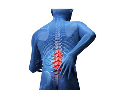 腰椎間旁突出的日常保健可做這些鍛煉