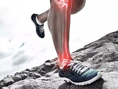 跑步：怎麼面對肌肉拉傷胫骨痛跟腱炎