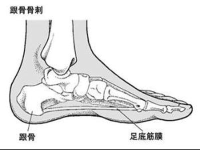 當心！5個誘發頸椎病的習慣