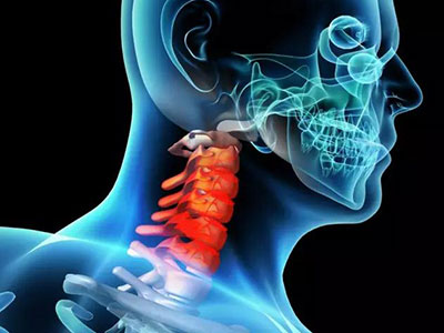 強直性脊柱炎患者五大注意事項