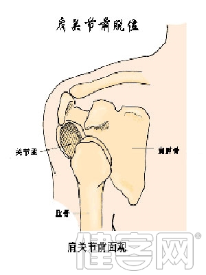 類風濕關節炎如何保健預防