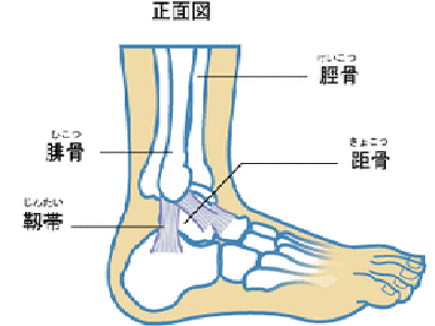 骨折這四點並發症會奪人命