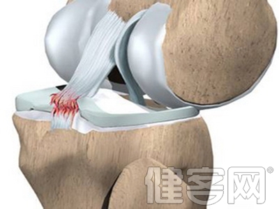如何保護膝關節不受傷