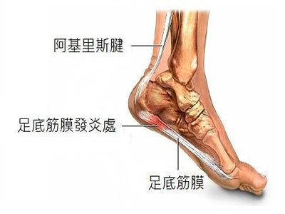 肌腱斷裂通常更需要手術及時修復