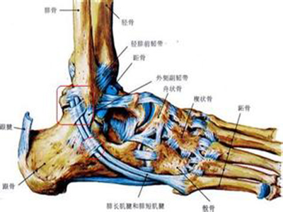 踝關節扭傷後疼痛和不穩定的手術治療