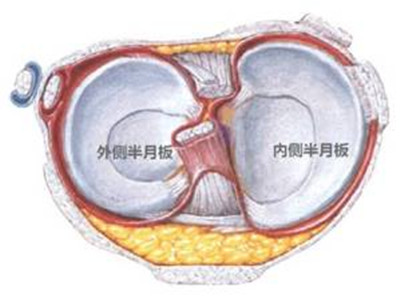 半月板撕裂有哪些治療方法