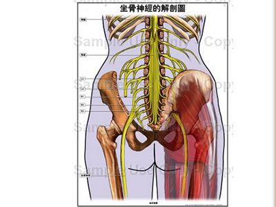 腰大肌肌溝阻滯治療<a name='InnerLinkKeyWord' href='http://www.jianke.com/gkpd/808157.html' _fcksavedurl='http://www.jianke.com/gkpd/808157.html' target='_blank'>坐骨神經痛</a>