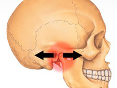 捻轉法治療颞下颌關節脫位
