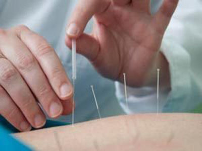 針灸療法能否有效治療頸椎病