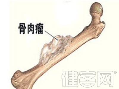 中醫如何治療骨腫瘤