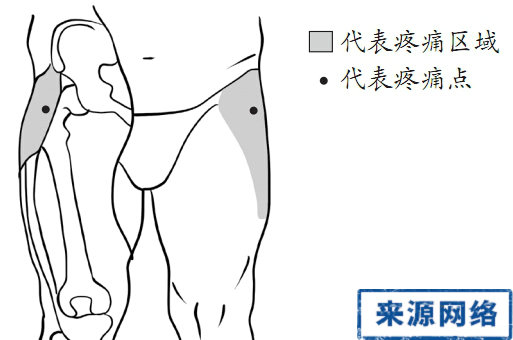 臀部疼痛的治療方法 3A姿勢診斷 3A姿勢療法