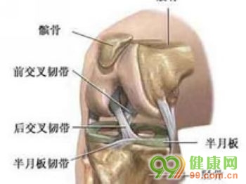 膝關節骨質增生 骨質增生 預防骨質增生 腰椎骨質增生 外傷